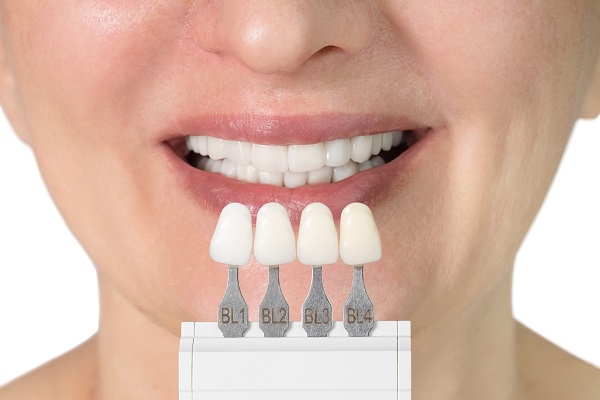 Veneers To Fix Tooth Imperfections