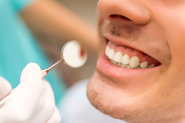 Preventive General Dentistry Treatments