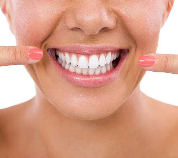 Dubuque What Is Gum Contouring and Reshaping