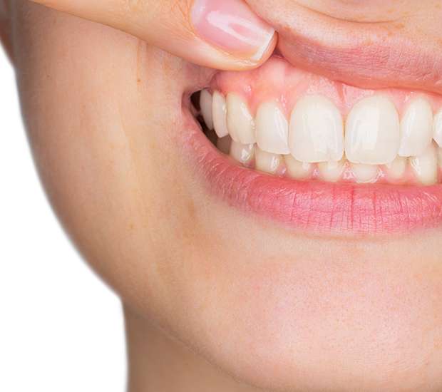 Dubuque Gum Disease