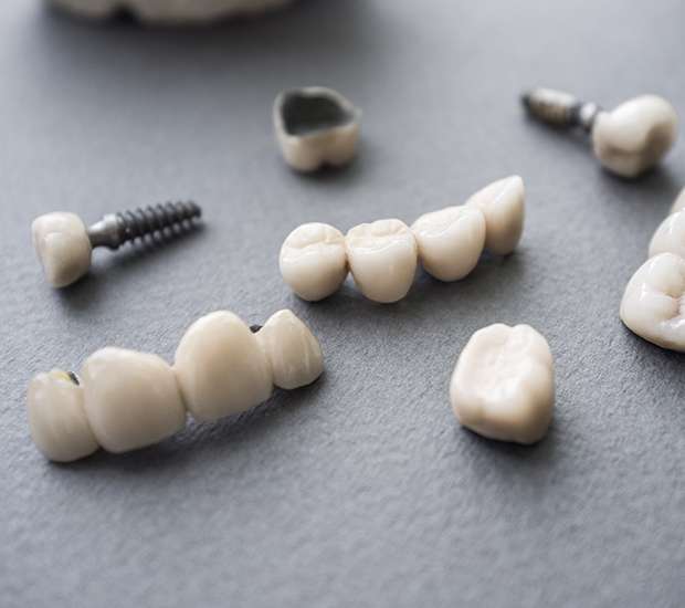 Dubuque The Difference Between Dental Implants and Mini Dental Implants