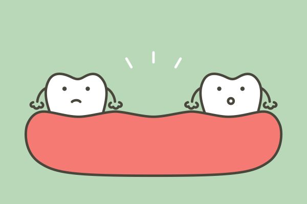 Dental Options For Replacing Missing Teeth