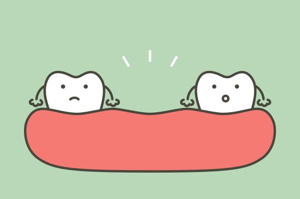 missing teeth missing teeth