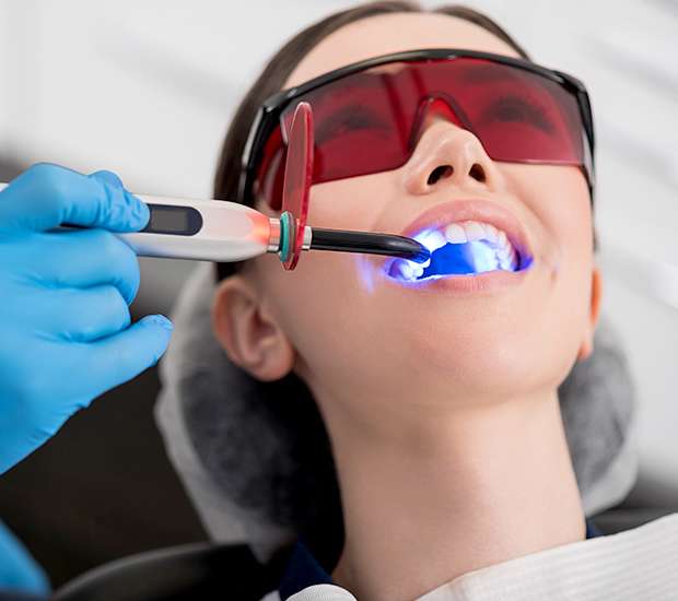 Dubuque Professional Teeth Whitening