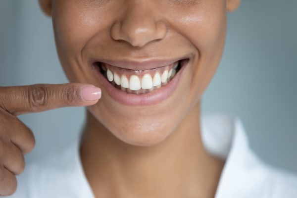 Benefits Of Teeth Whitening
