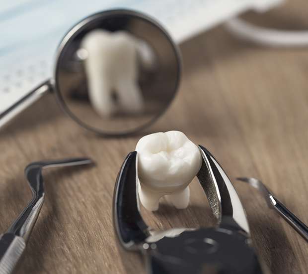 Dubuque When Is a Tooth Extraction Necessary