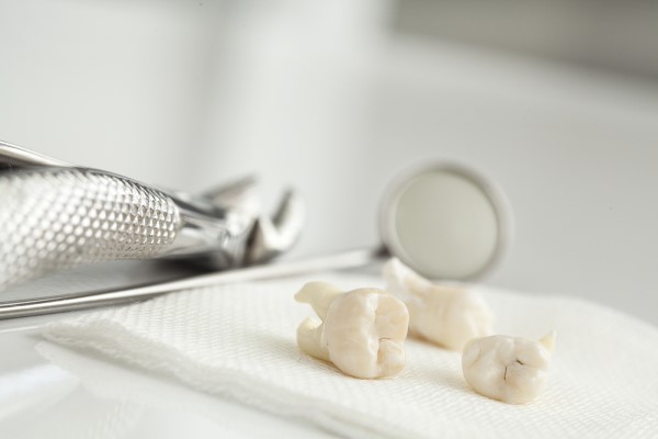 Signs You May Need A Wisdom Tooth Extraction